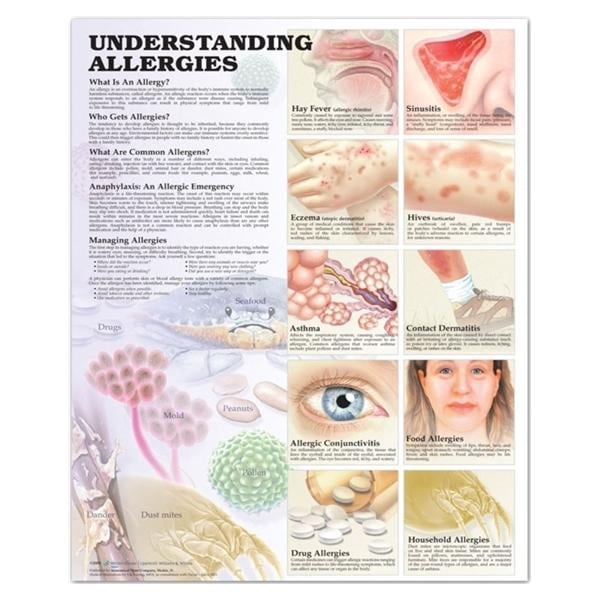 Wolters Kluwer Health Inc Understanding Allergies 20x26" Educational Chart Ea - 9781587799402