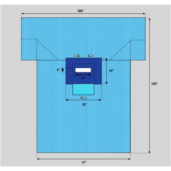 Welmed Inc -106x77x120" Sterile Transverse Laparotomy Drape 14x4" Fenestrated 1222-2130