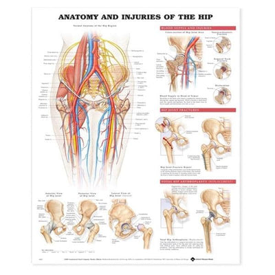 Wolters Kluwer Health Inc Injuries of the Hip 20x26" Anatomical Chart Ea - 9781587793820