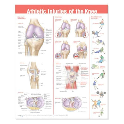 Wolters Kluwer Health Inc Athletic Injuries of The Knee 20x26" Anatomical Chart Ea - 9780781786720