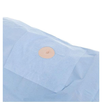 O & M Halyard -76x124" Sterile Surgical Drape 6x6" Fenestration 89531