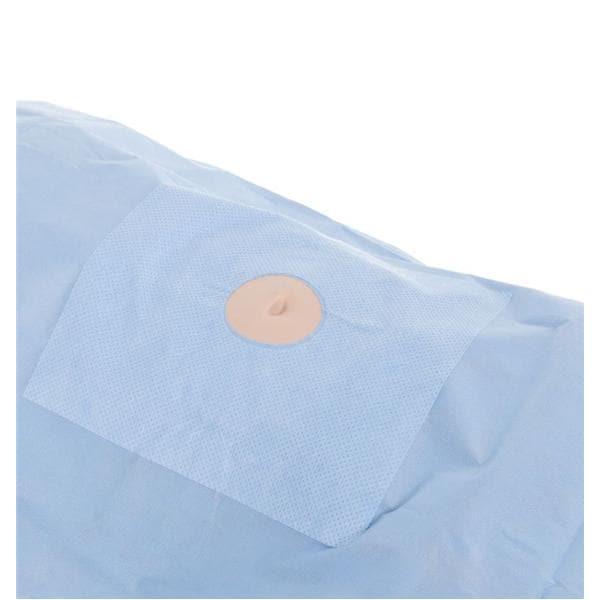 O & M Halyard -76x124" Sterile Surgical Drape 6x6" Fenestration 89531