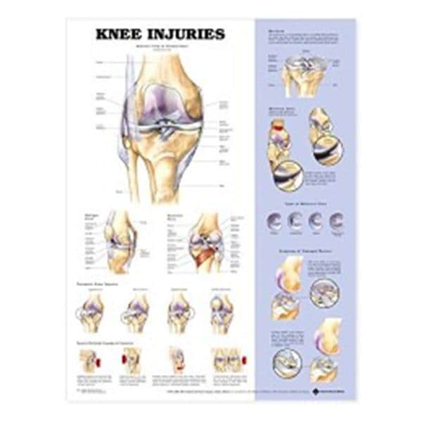 Wolters Kluwer Health Inc Chart Anatomical Knee Injuries Ea - 9781587797576