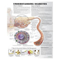 Wolters Kluwer Health Inc Understanding Diabetes Educational Chart Ea - 9781469894928