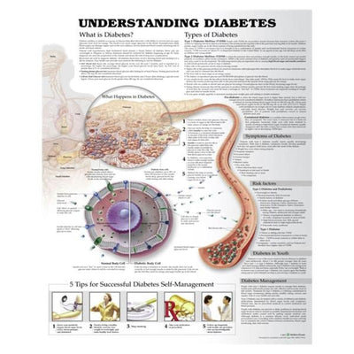 Wolters Kluwer Health Inc Understanding Diabetes Educational Chart Ea - 9781469894928