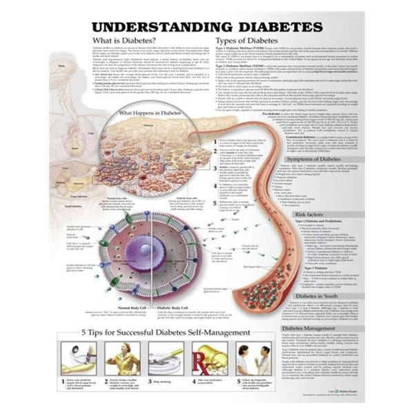Wolters Kluwer Health Inc Understanding Diabetes Educational Chart Ea - 9781469894928