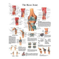 Fabrication Enterprises Knee Joint 20x25" Anatomical Chart Ea - 12-4611L