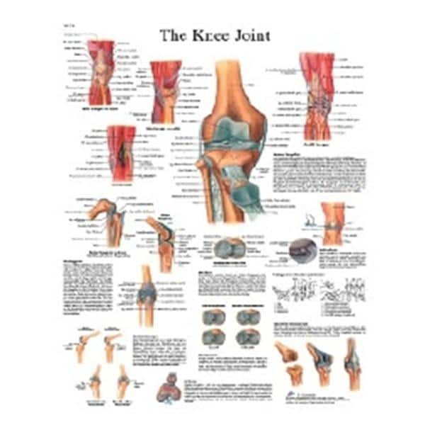 Fabrication Enterprises Knee Joint 20x25" Anatomical Chart Ea - 12-4611L