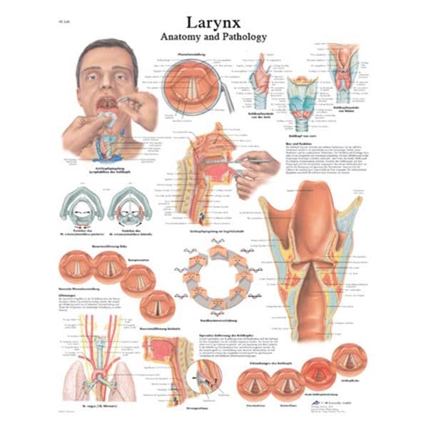 Fabrication Enterprises Larnyx 20x25" Anatomical Chart Ea - 12-4612L