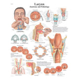 Fabrication Enterprises Larnyx 20x25" Anatomical Chart Ea - 12-4612L