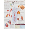 Wolters Kluwer Health Inc Understanding Hypertension 20x26" Laminated Wall Chart Ea - 9781496369819