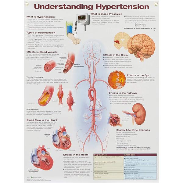Wolters Kluwer Health Inc Understanding Hypertension 20x26" Laminated Wall Chart Ea - 9781496369819