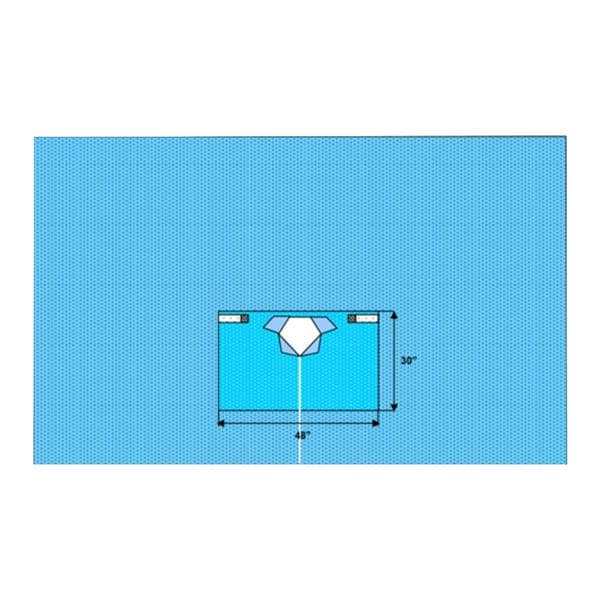 Welmed Inc -172x100" Sterile Sheet Drape Fenestrated 1222-8662