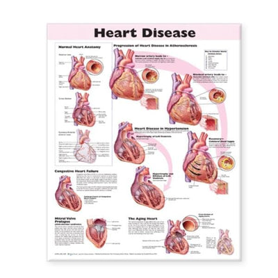 Wolters Kluwer Health Inc Heart Disease 20x26" Educational Poster Ea - 9780781773386