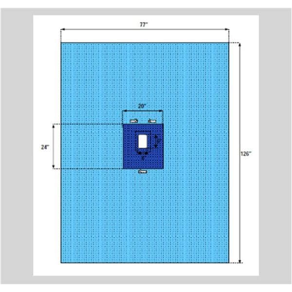 Welmed Inc -77x126" Sterile Laparotomy Drape Fenestrated 1222-2125