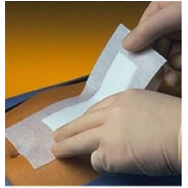 Smith & Nephew Wound Care Primapore Polyester Post Op Island Dressing 6x3-1/8" Sterile LF, 10 BX/CA - 66000318