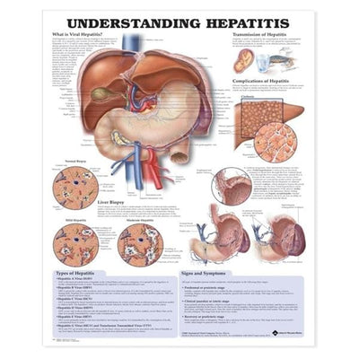 Wolters Kluwer Health Inc Understanding Hepatitis 20x26" Educational Chart Ea - 9781587794186