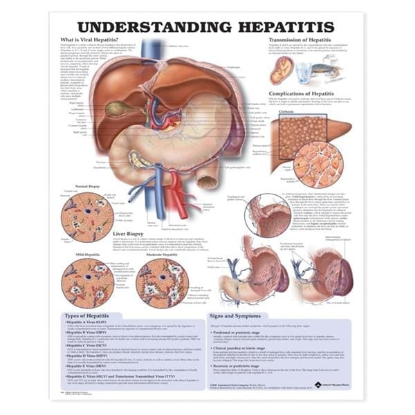 Wolters Kluwer Health Inc Understanding Hepatitis 20x26" Educational Chart Ea - 9781587794186