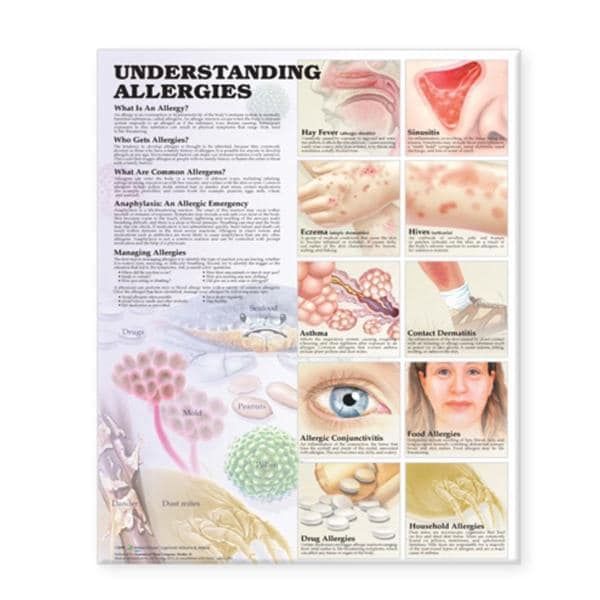 Wolters Kluwer Health Inc Understanding Allergies 20x26" Educational Chart Ea - 9781587799419