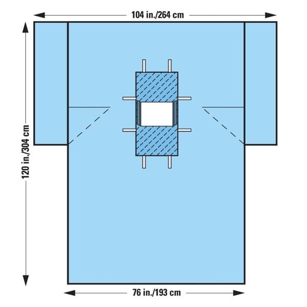 O & M Halyard -104x76x120" Sterile Laparotomy/Cholecystectomy Drape 12x13" Fenestrated 89229