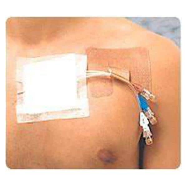 Integra LifeSciences Corp Cath-Strip Catheter Fastener - CS50
