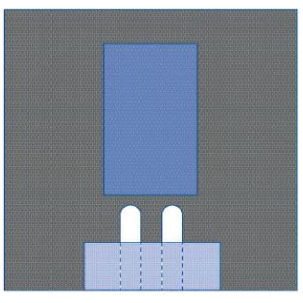 Medline Industries Inc -77x80" Sterile Surgical Drape Fenestrated DYNJP4007