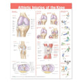 Wolters Kluwer Health Inc Knee Injuries 20x26" Educational Chart Ea - 978078178675