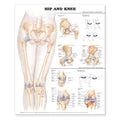 Wolters Kluwer Health Inc Hip And Knee 20x26" Anatomical Chart Ea - 9781587798672