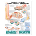 Wolters Kluwer Health Inc Understanding Carpal Tunnel Syndrome 20x26" Educational Chart Ea - 9781587793219