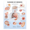 Wolters Kluwer Health Inc Dangers of Smoking 20x26" Educational Chart EA - 9781587792311