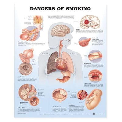 Wolters Kluwer Health Inc Dangers of Smoking 20x26" Educational Chart EA - 9781587792311