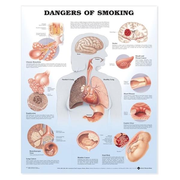 Wolters Kluwer Health Inc Dangers of Smoking 20x26" Educational Chart EA - 9781587792311