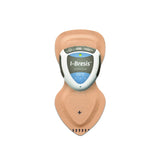 I-Bresis Hybrid Iontophoresis System