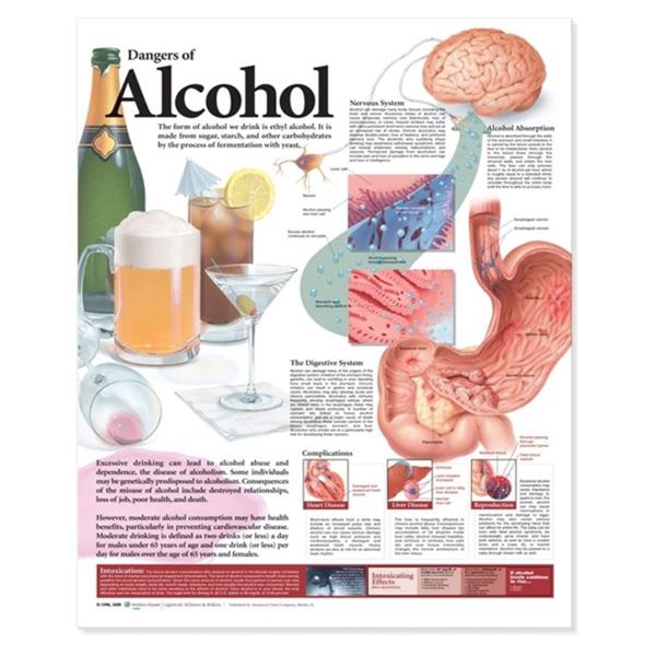 Wolters Kluwer Health Inc Dangers of Alcohol 20x26" Educational Chart Ea - 9780781782395