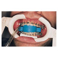 Ortho Arch Co -Cotton Mouth Prop Autoclavable Each 900-200