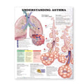 Wolters Kluwer Health Inc Understanding Asthma 20x26" Educational Chart EA - 9781587799389