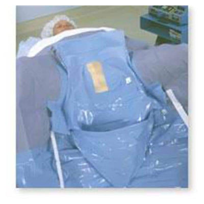 Microtek Inc -Drape Lingeman pack Fenestrated 6/Case 1-0426