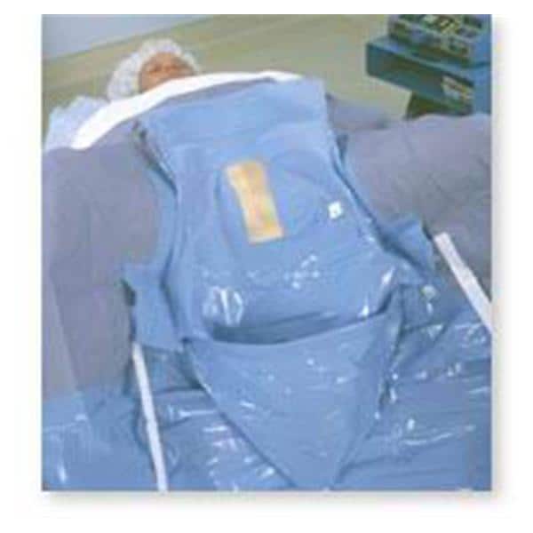 Microtek Inc -Drape Lingeman pack Fenestrated 6/Case 1-0426