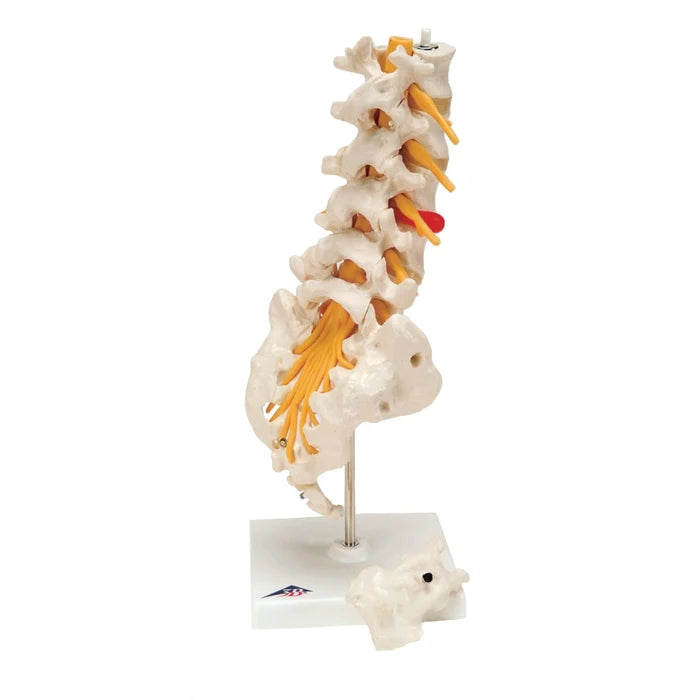 Prolapsed Lumbar Section with Herniated Disk (Packaging - Each)
