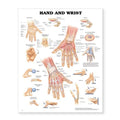 Wolters Kluwer Health Inc Hand And Wrist 20x26" Anatomical Chart EA - 9781587796944