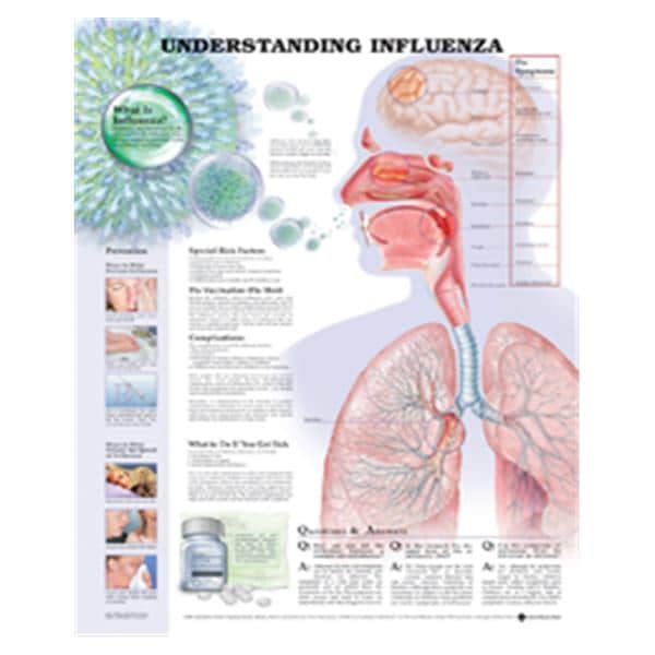 Wolters Kluwer Health Inc Understanding Influenza 20x26" Educational Chart Ea - 9781587798863