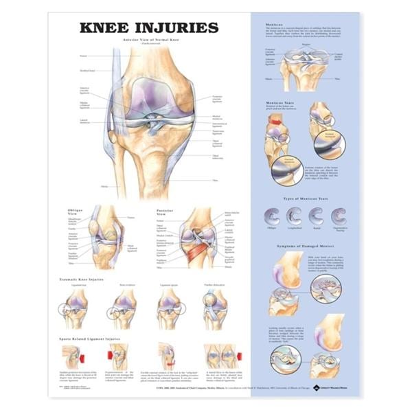 Wolters Kluwer Health Inc Knee Injuries 20x26" Anatomical Chart Ea - 9781587797576