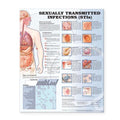 Wolters Kluwer Health Inc Sexually Transmitted Infections 20x26" Educational Chart Ea - 9781587798504