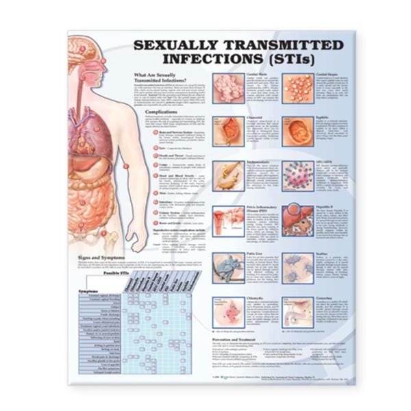 Wolters Kluwer Health Inc Sexually Transmitted Infections 20x26" Educational Chart Ea - 9781587798504