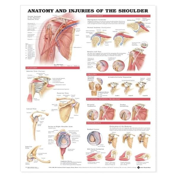 Wolters Kluwer Health Inc Anatomy and Injuries of the Shoulder 20x26" Anatomical Chart Ea  - 9781587798085