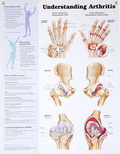 North Coast Anatomical Wall Charts, Vinyl-Laminated, Medical Condition