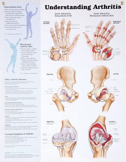 North Coast Anatomical Wall Charts, Vinyl-Laminated, Medical Condition