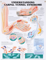 North Coast Anatomical Wall Charts, Vinyl-Laminated, Medical Condition