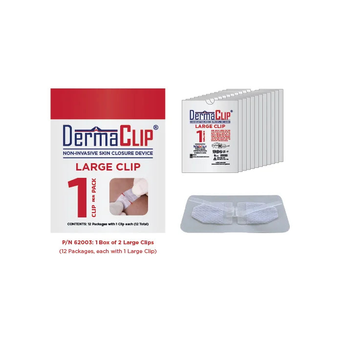 DermaClip Non-Invasive Skin Closure