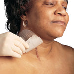 Mepiform Self-Adherent Silicone Dressing